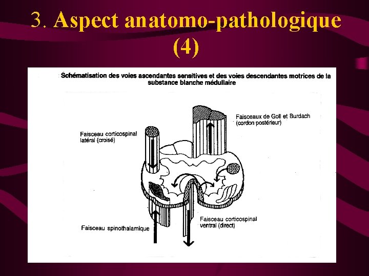 3. Aspect anatomo-pathologique (4) 