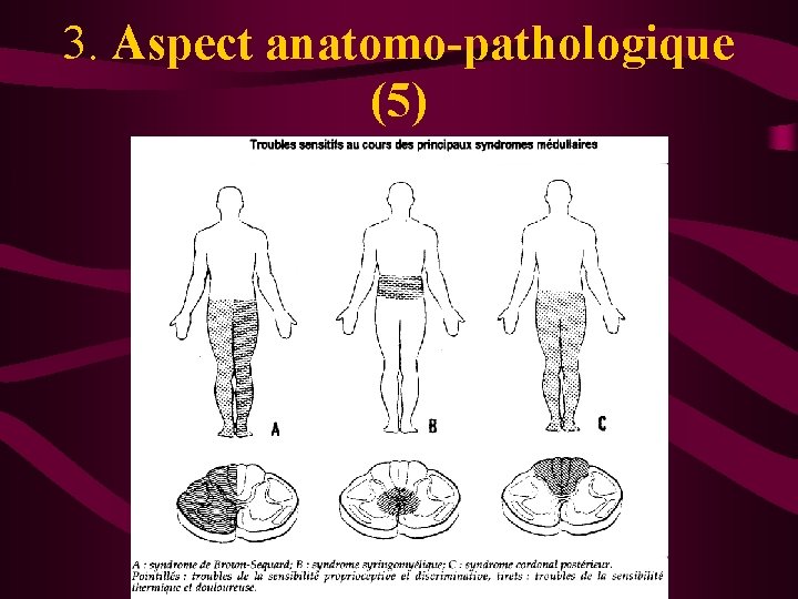 3. Aspect anatomo-pathologique (5) 