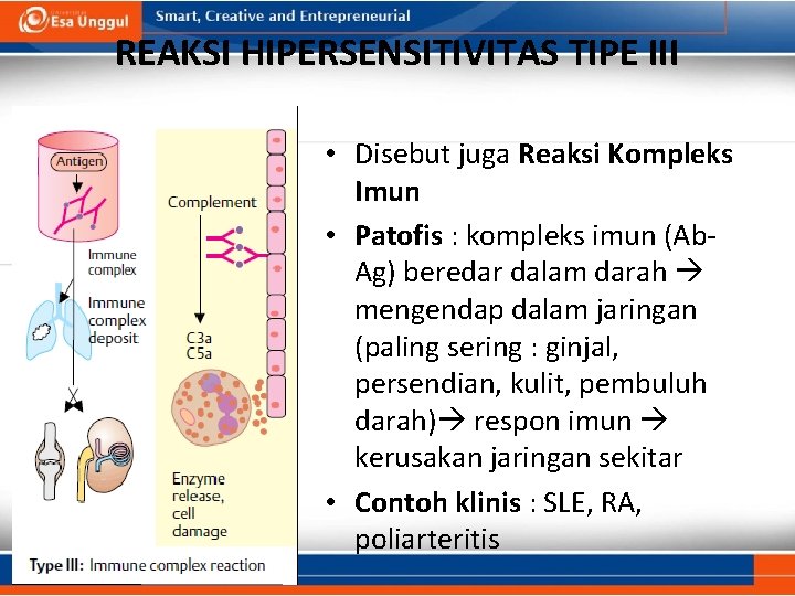 REAKSI HIPERSENSITIVITAS TIPE III • Disebut juga Reaksi Kompleks Imun • Patofis : kompleks