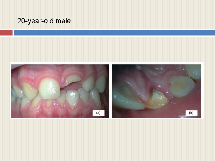 20 -year-old male 