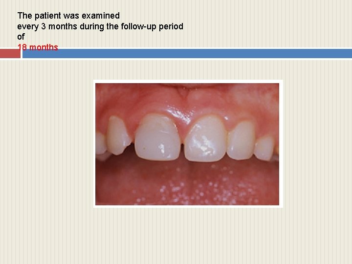 The patient was examined every 3 months during the follow-up period of 18 months