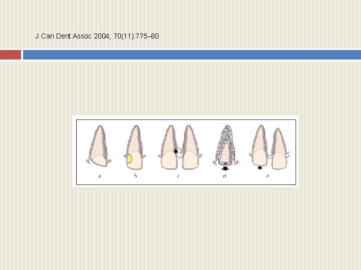 J Can Dent Assoc 2004; 70(11): 775– 80 