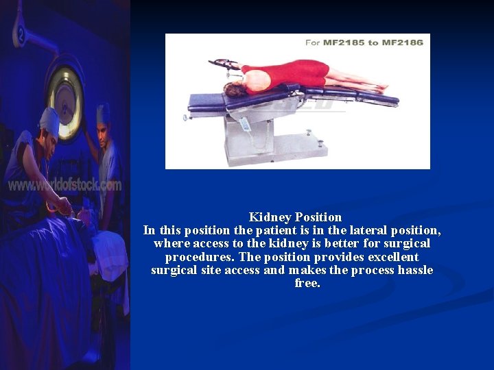 Kidney Position In this position the patient is in the lateral position, where access