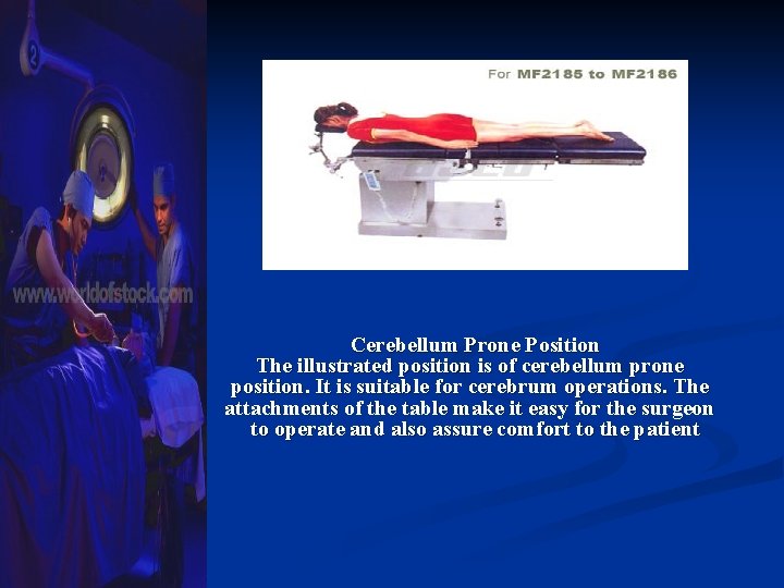 Cerebellum Prone Position The illustrated position is of cerebellum prone position. It is suitable