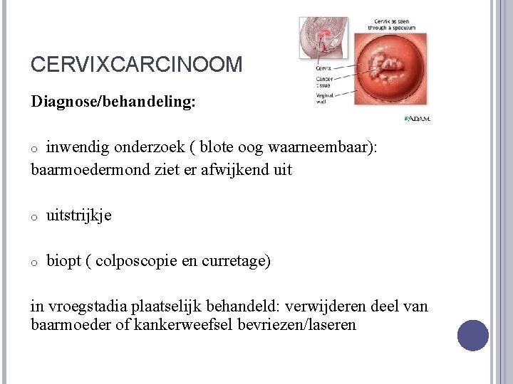 CERVIXCARCINOOM Diagnose/behandeling: inwendig onderzoek ( blote oog waarneembaar): baarmoedermond ziet er afwijkend uit o