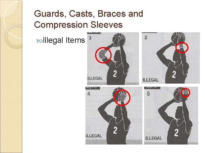 Guards, Casts, Braces and Compression Sleeves Illegal Items 