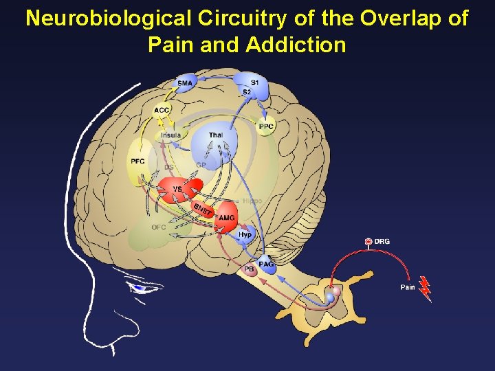 Neurobiological Circuitry of the Overlap of Pain and Addiction 