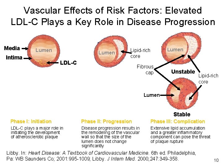 Vascular Effects of Risk Factors: Elevated LDL-C Plays a Key Role in Disease Progression