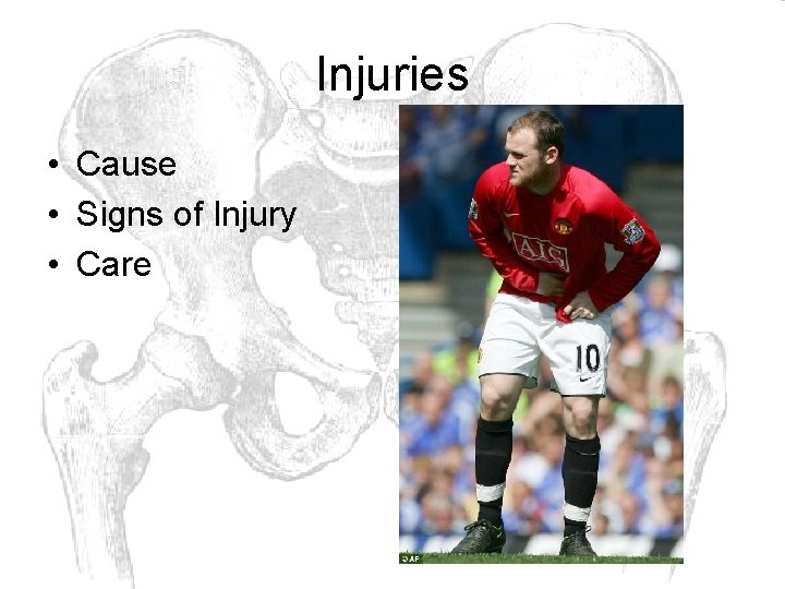 Injuries • Cause • Signs of Injury • Care 