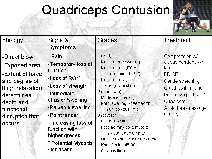 Quadriceps Contusion Etiology Signs & Symptoms Grades Treatment -Direct blow -Exposed area -Extent of