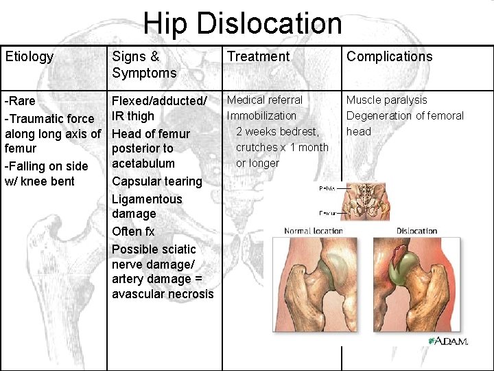 Hip Dislocation Etiology Signs & Symptoms Treatment Complications -Rare -Traumatic force along axis of