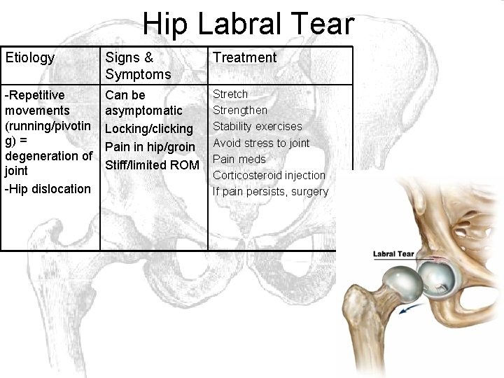 Hip Labral Tear Etiology Signs & Symptoms Treatment -Repetitive movements (running/pivotin g) = degeneration