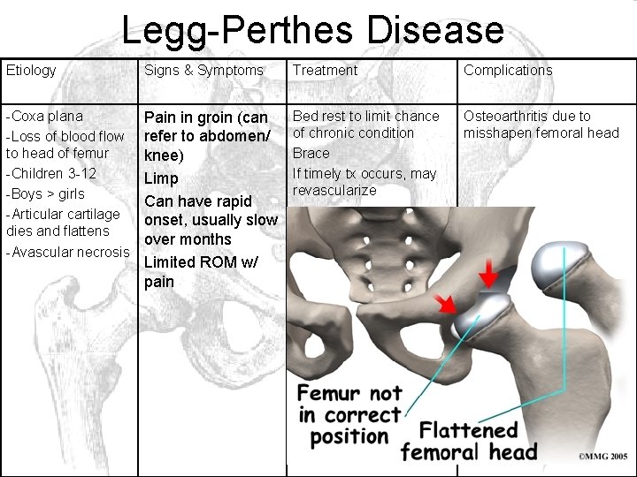 Legg-Perthes Disease Etiology Signs & Symptoms Treatment Complications -Coxa plana -Loss of blood flow