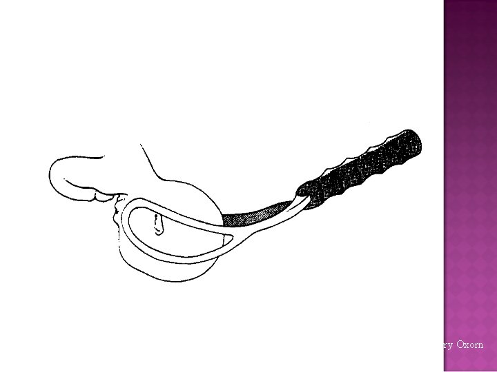 From: Human Labour & Birth, Harry Oxorn 