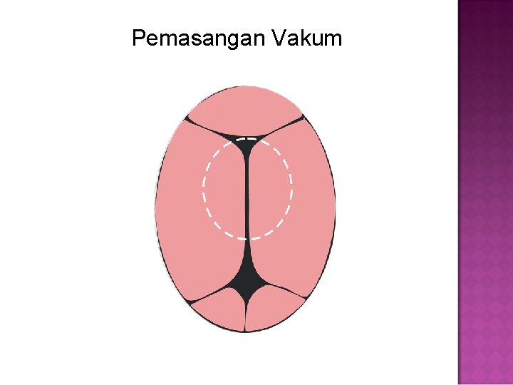 Pemasangan Vakum 