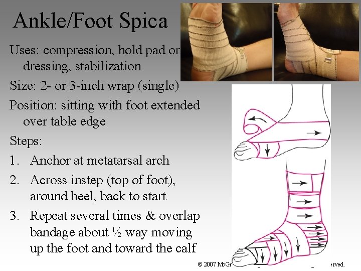 Ankle/Foot Spica Uses: compression, hold pad or dressing, stabilization Size: 2 - or 3