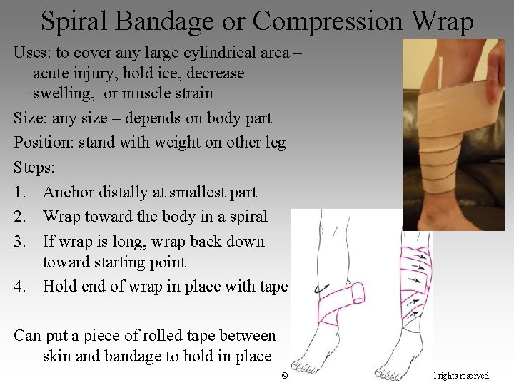 Spiral Bandage or Compression Wrap Uses: to cover any large cylindrical area – acute