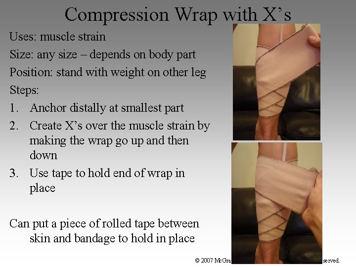 Compression Wrap with X’s Uses: muscle strain Size: any size – depends on body