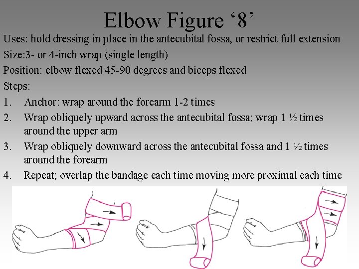 Elbow Figure ‘ 8’ Uses: hold dressing in place in the antecubital fossa, or