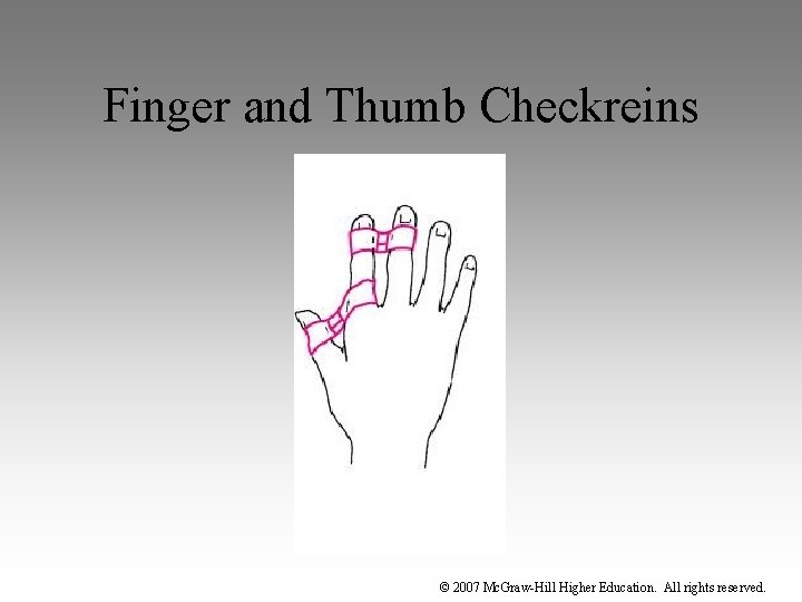 Finger and Thumb Checkreins © 2007 Mc. Graw-Hill Higher Education. All rights reserved. 