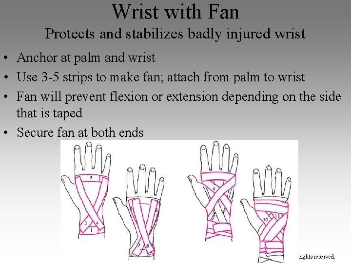 Wrist with Fan Protects and stabilizes badly injured wrist • Anchor at palm and