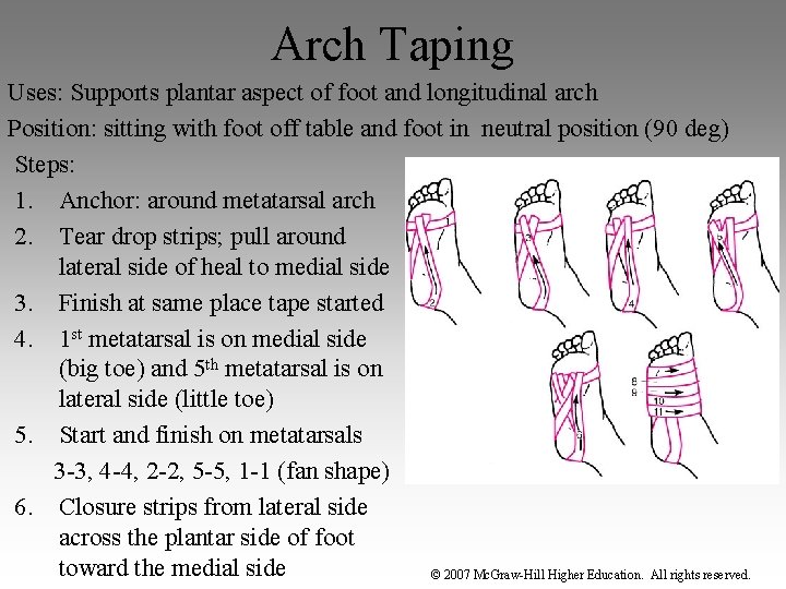 Arch Taping Uses: Supports plantar aspect of foot and longitudinal arch Position: sitting with