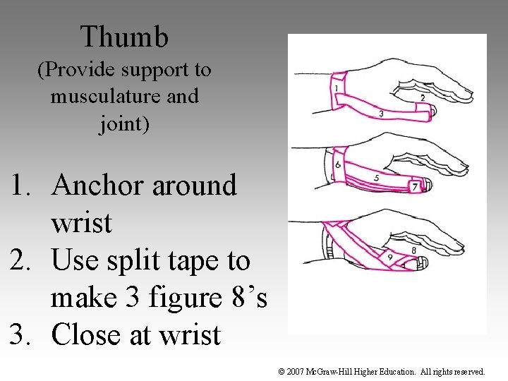 Thumb (Provide support to musculature and joint) 1. Anchor around wrist 2. Use split