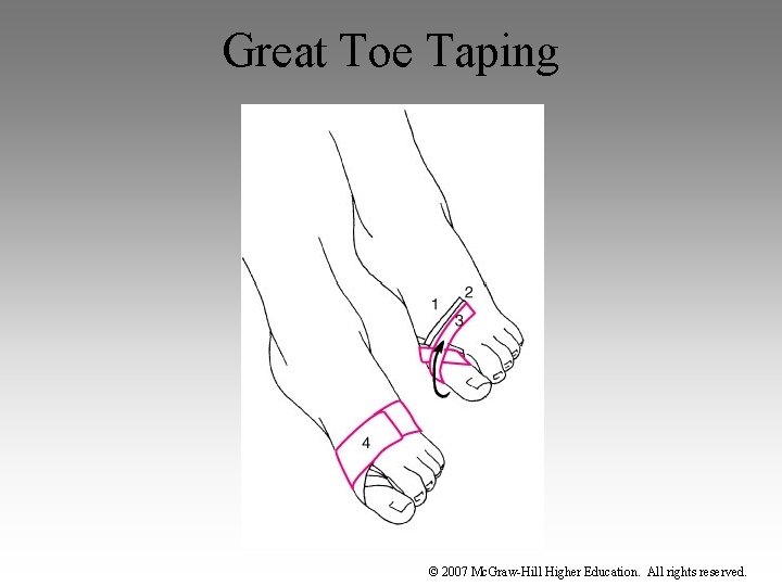 Great Toe Taping © 2007 Mc. Graw-Hill Higher Education. All rights reserved. 