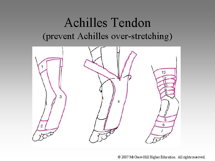Achilles Tendon (prevent Achilles over-stretching) © 2007 Mc. Graw-Hill Higher Education. All rights reserved.