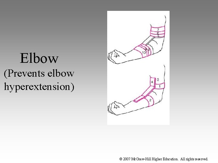 Elbow (Prevents elbow hyperextension) © 2007 Mc. Graw-Hill Higher Education. All rights reserved. 