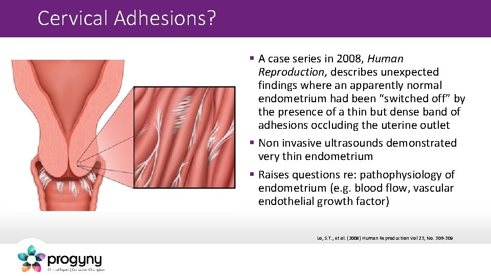 Cervical Adhesions? § A case series in 2008, Human Reproduction, describes unexpected findings where