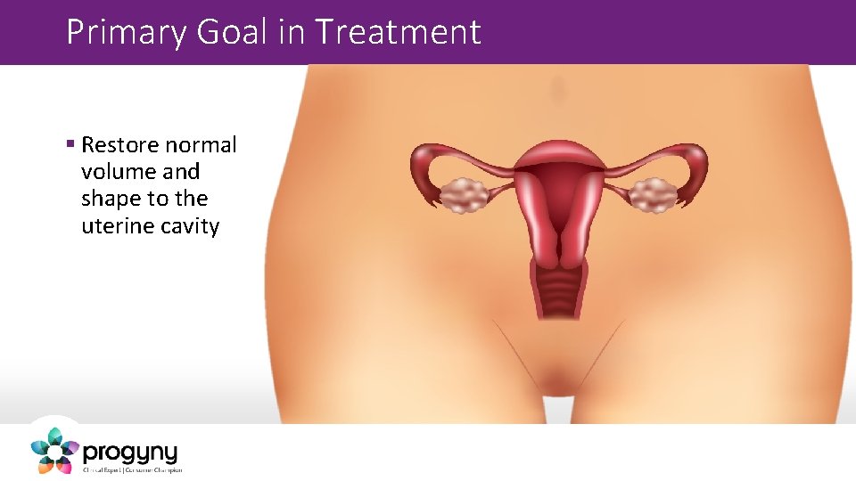 Primary Goal in Treatment § Restore normal volume and shape to the uterine cavity
