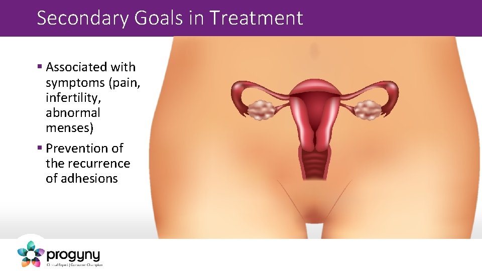 Secondary Goals in Treatment § Associated with symptoms (pain, infertility, abnormal menses) § Prevention