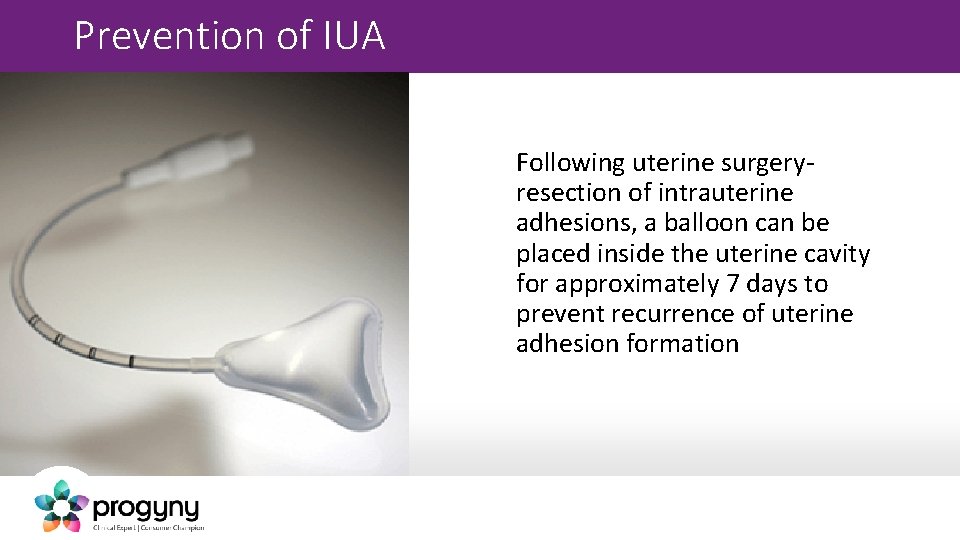 Prevention of IUA Following uterine surgeryresection of intrauterine adhesions, a balloon can be placed