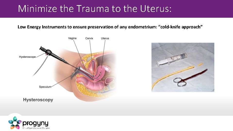 Minimize the Trauma to the Uterus: Low Energy Instruments to ensure preservation of any