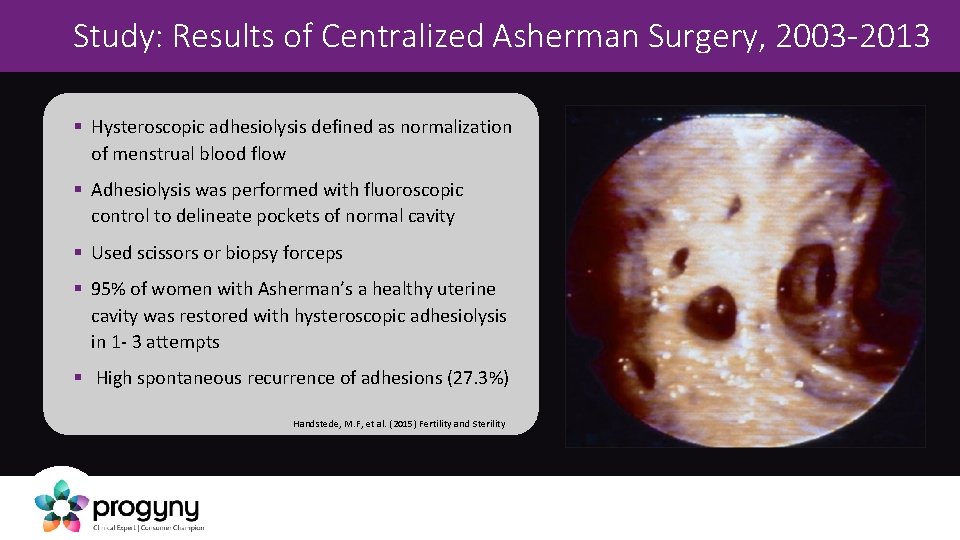 Study: Results of Centralized Asherman Surgery, 2003 -2013 § Hysteroscopic adhesiolysis defined as normalization