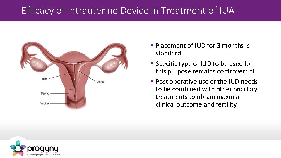 Efficacy of Intrauterine Device in Treatment of IUA § Placement of IUD for 3