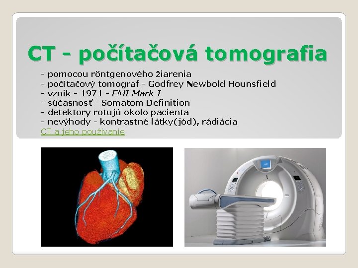 CT - počítačová tomografia - pomocou röntgenového žiarenia - počítačový tomograf - Godfrey Newbold