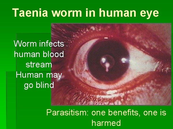 Taenia worm in human eye Worm infects human blood stream Human may go blind