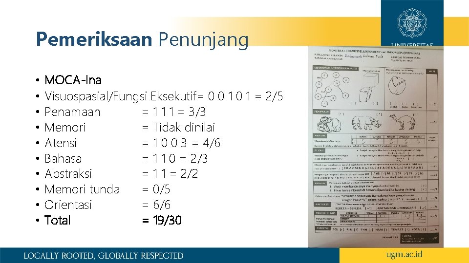 Pemeriksaan Penunjang • • • MOCA-Ina Visuospasial/Fungsi Eksekutif= 0 0 1 = 2/5 Penamaan