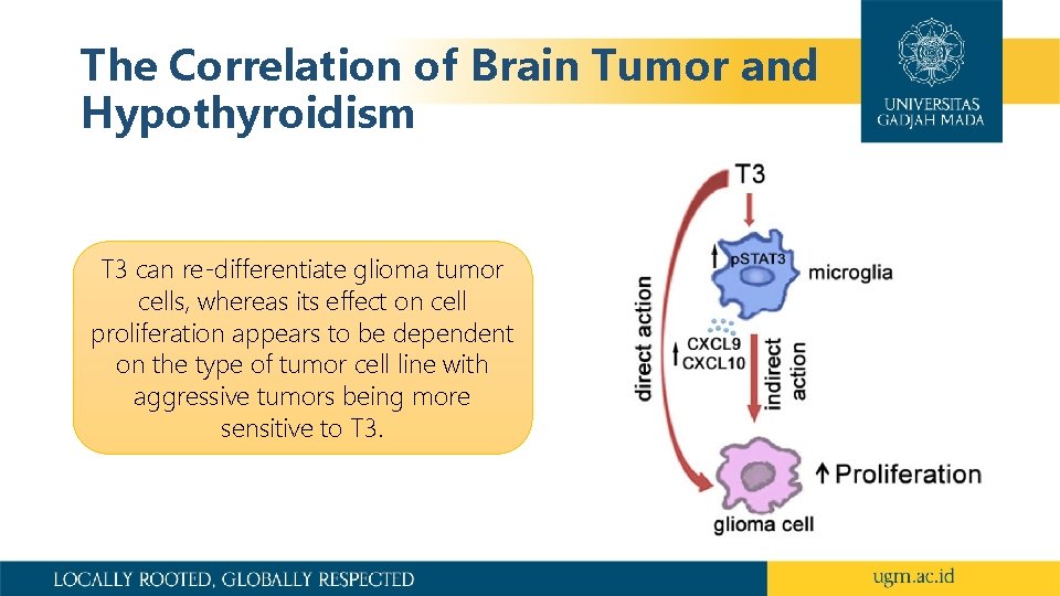 The Correlation of Brain Tumor and Hypothyroidism T 3 can re-differentiate glioma tumor cells,