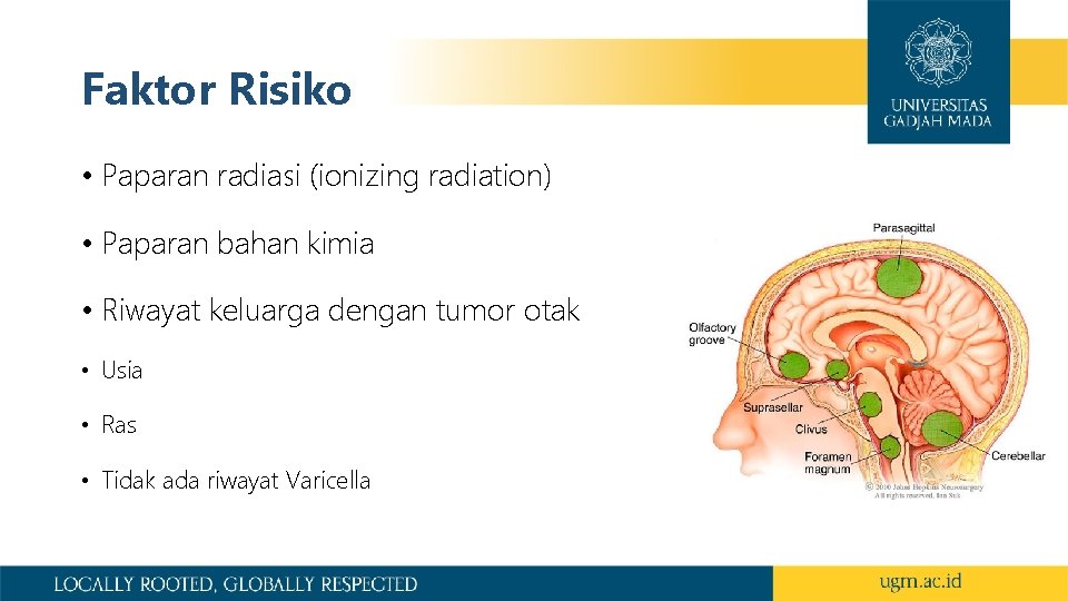 Faktor Risiko • Paparan radiasi (ionizing radiation) • Paparan bahan kimia • Riwayat keluarga