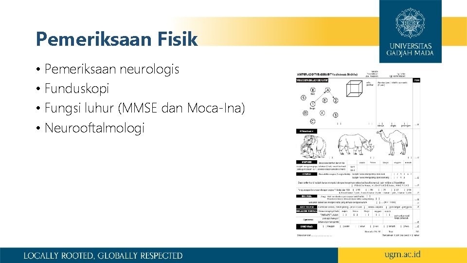 Pemeriksaan Fisik • Pemeriksaan neurologis • Funduskopi • Fungsi luhur (MMSE dan Moca-Ina) •