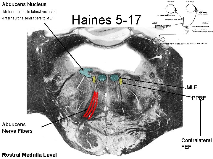 Abducens Nucleus -Motor neurons to lateral rectus m. -Interneurons send fibers to MLF Haines