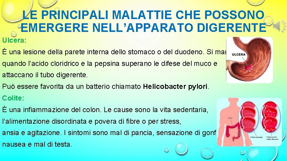 LE PRINCIPALI MALATTIE CHE POSSONO EMERGERE NELL’APPARATO DIGERENTE Ulcera: È una lesione della parete