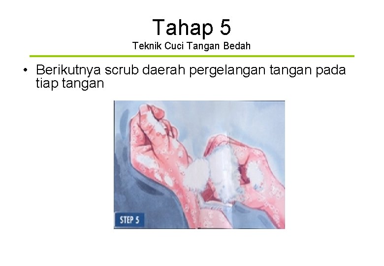 Tahap 5 Teknik Cuci Tangan Bedah • Berikutnya scrub daerah pergelangan tangan pada tiap