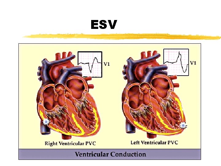 ESV 