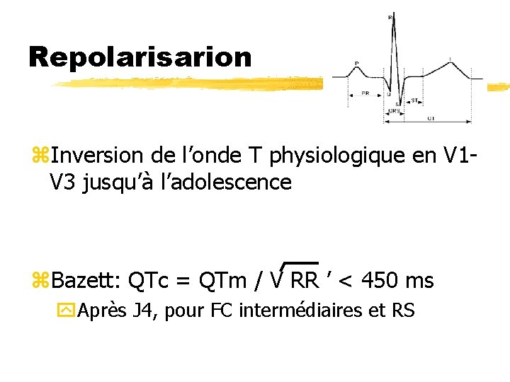 Repolarisarion z. Inversion de l’onde T physiologique en V 1 V 3 jusqu’à l’adolescence