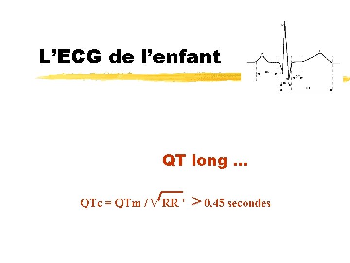 L’ECG de l’enfant QT long … QTc = QTm / V RR ’ >