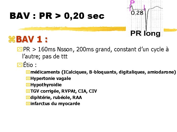 BAV : PR > 0, 20 sec z. BAV 1 : y. PR >